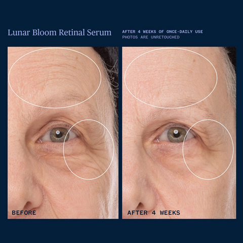 Lunar Bloom Retinal Serum