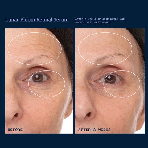 Lunar Bloom Retinal Serum