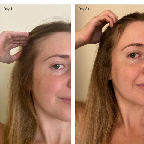 holi (growth) 84 Leave-In Hair Growth Scalp Spray