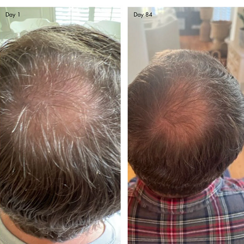 holi (growth) 84 Leave-In Hair Growth Scalp Spray