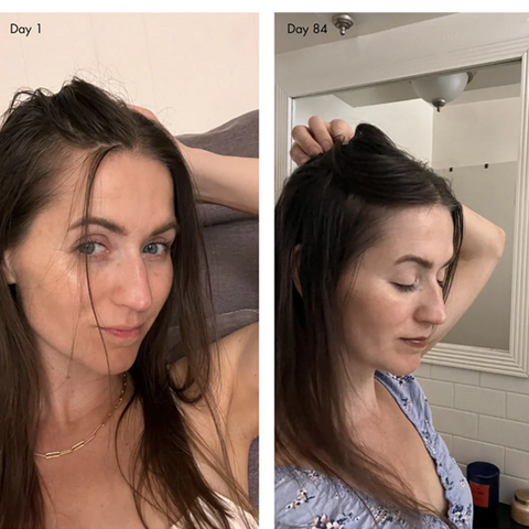 holi (growth) 84 Leave-In Hair Growth Scalp Spray