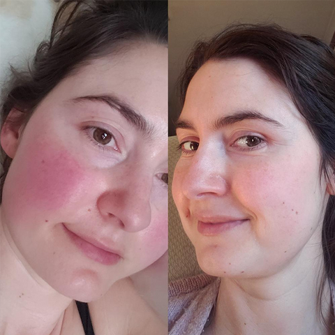 Pure - Sensitive Care Complex