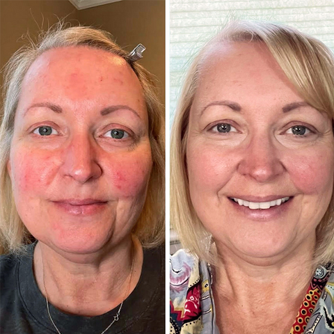 Pure - Sensitive Care Complex