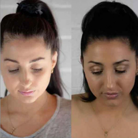 Power Fol™ Advanced Multi-correctional Scalp & Hair Treatment