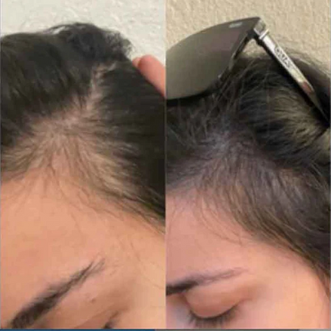 Power Fol™ Advanced Multi-correctional Scalp & Hair Treatment