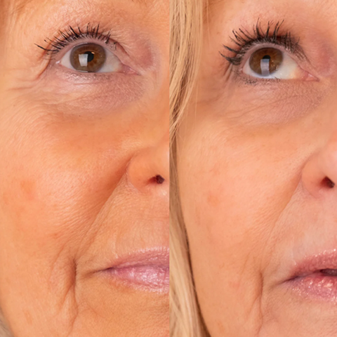 Eyelash Growth Serum