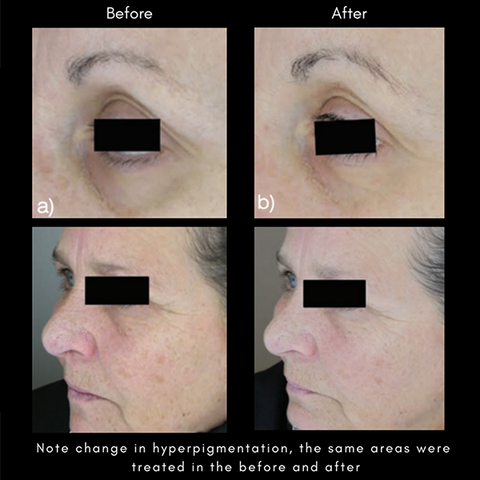 The Advanced Response Complex Regenerating Face & Neck Cream