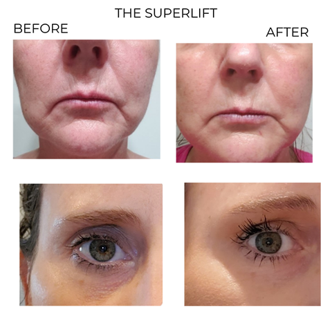 The Super Lift Vitamin C-More Treatment